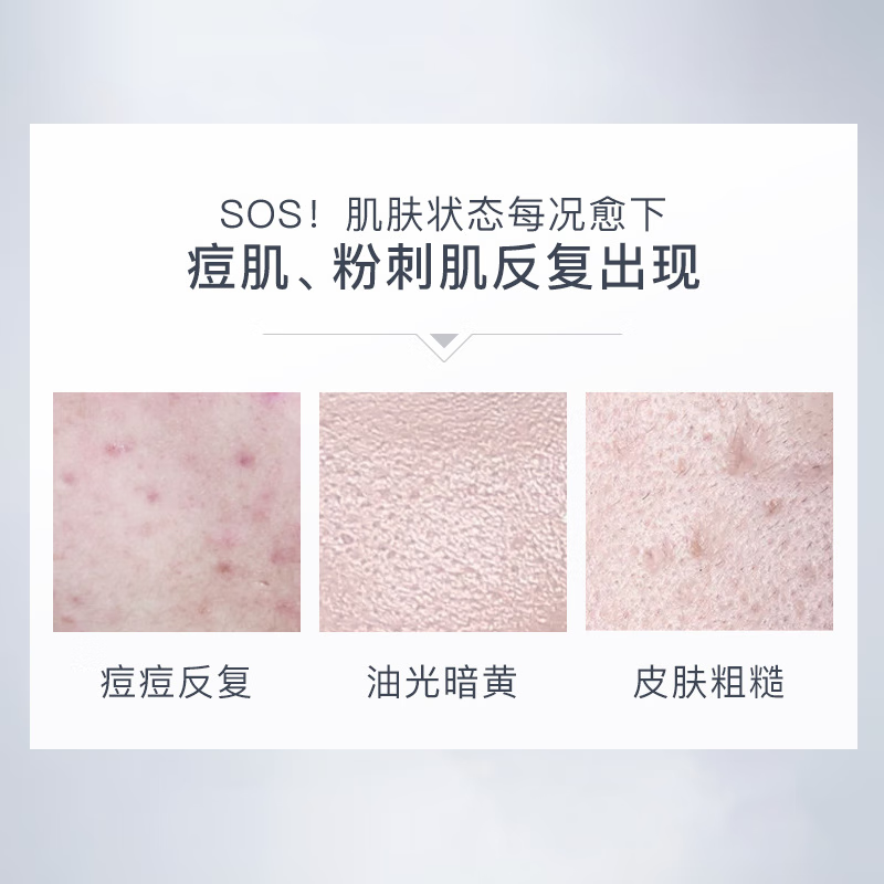 芙诗婷杏仁酸精华液6%改善痘肌清理闭口黑头粉刺收敛粗大毛孔控油去角质 6%杏仁酸精华30ml*2 30ml/瓶