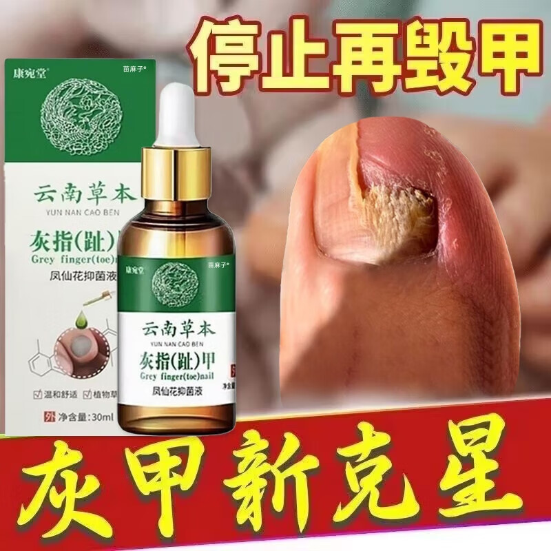 云南本草鳳仙花治療灰指甲護(hù)理液灰指甲專用指甲真菌感染脫甲壞甲液官方店 云南草本1瓶裝