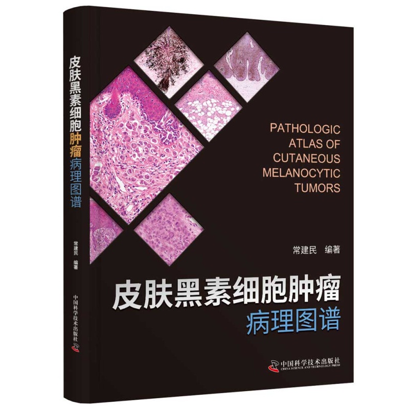 皮肤黑素细胞肿瘤病理图谱