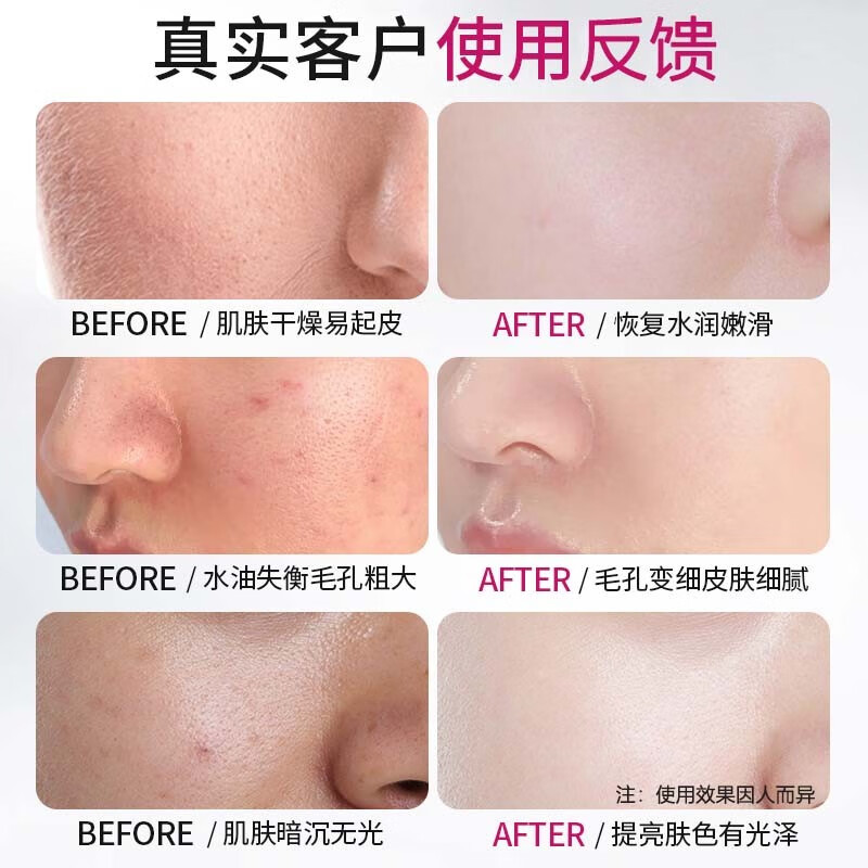 BAILUHUI【官方授权】韩国玫瑰软膜粉面膜泥膜粉补水保湿提亮肤色涂抹面膜 2袋装【镇静褪红，嫩肤透亮】
