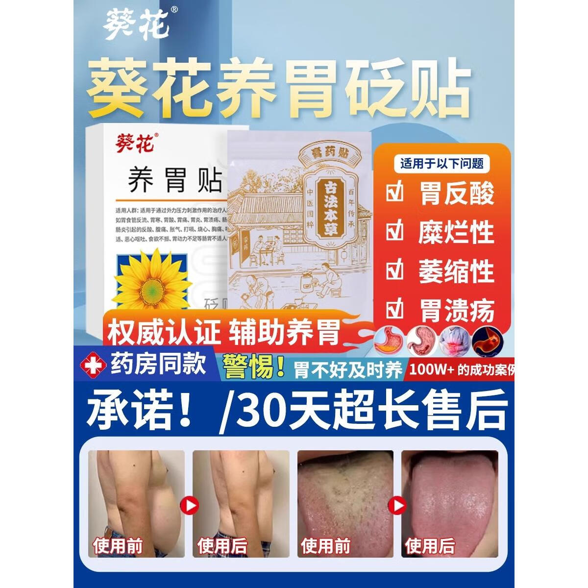 葵花养胃贴暖胃贴肠胃贴胃痛寒胀气酸穴位压力刺激正品[官方直售]旗舰