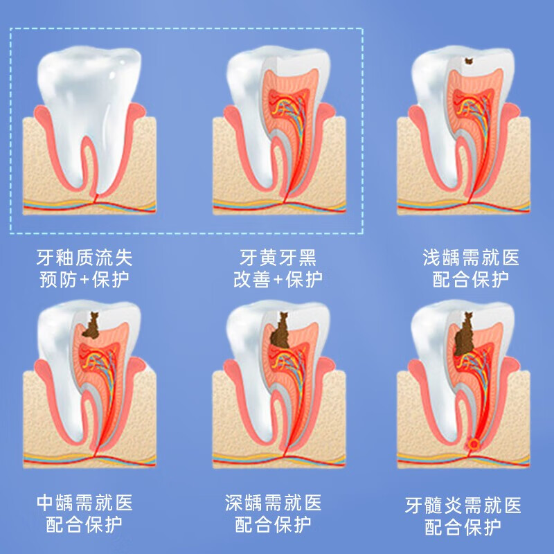 完好如初婴幼儿童牙膏6-12岁不含氟防蛀防龋齿3-6岁再生硅宝宝牙膏regesi 无氟防蛀40g4支【得1成人款】
