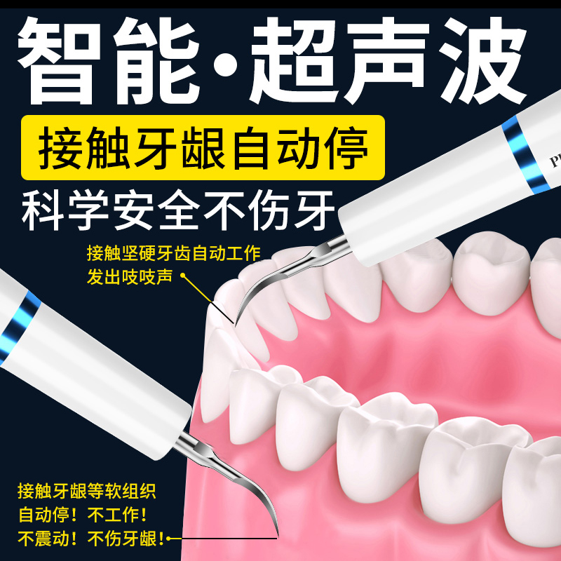 胖猫FATCAT真超声波洁牙器德国洗牙器牙结石去除器清理烟渍牙垢清洁神器黑黄牙齿的工具家用电动冲牙器 【魔力白】超声波4头带灯+口腔镜+墙架+洁牙8件套