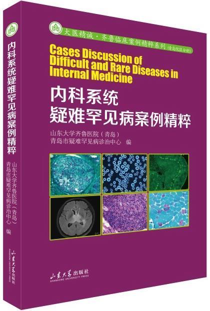 内科系统疑难罕见病案例精粹焉传祝山东大学出版社有限公司