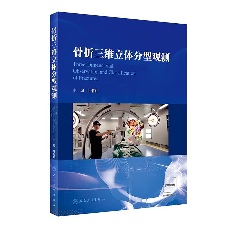 骨折三维立体分型观测