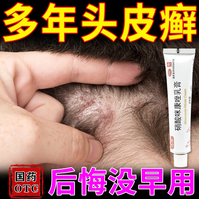 头皮癣专用otc药膏银屑头屑乳膏毛囊发炎头皮专科用药溢脂性皮炎头部