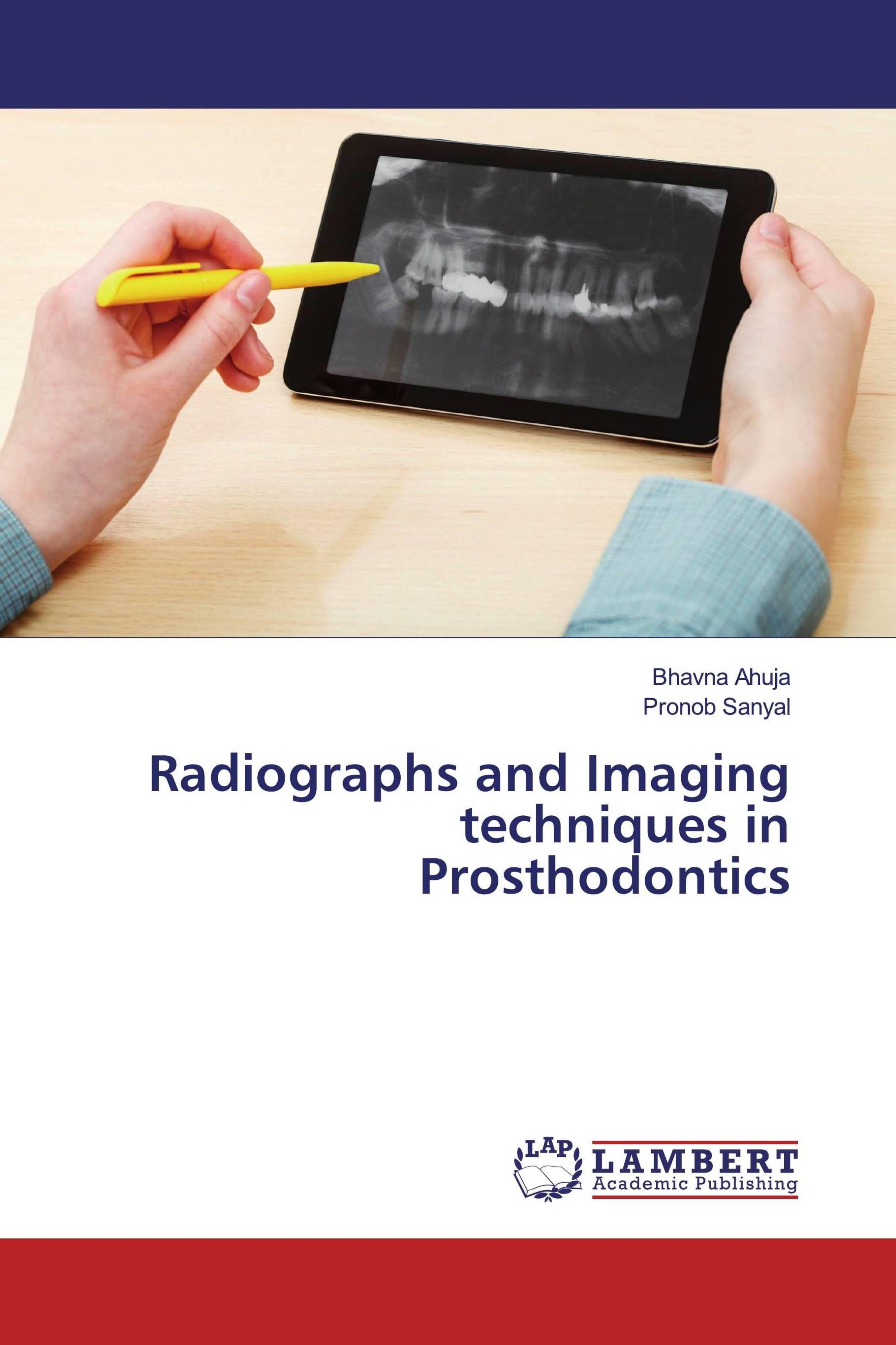 预订Radiographs and Imaging techniques in Prosthodon