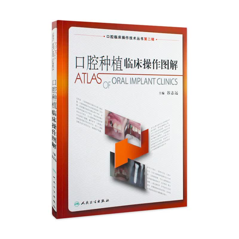 口腔种植临床操作图解 拔牙技巧学义齿全瓷修复颌面外科正畸黏膜病学牙髓之路儿童牙科病历根管治疗人民卫生出版社口腔医学书籍