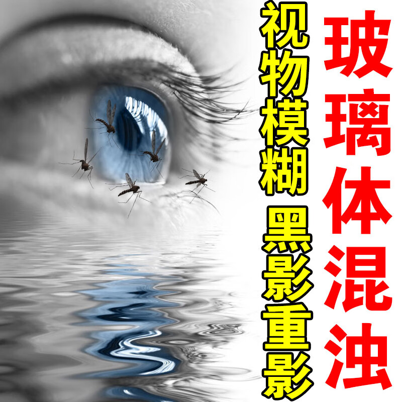 飞蚊康滴眼液飞蚊症专用眼水玻璃体混浊叶黄素滴眼液 单盒体验装建议