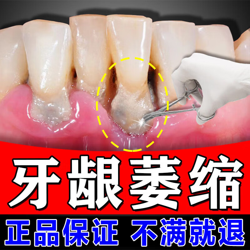 牙龈萎缩专用牙膏重度牙龈萎缩修复再生固齿专用牙齿松动牙龈萎缩 一
