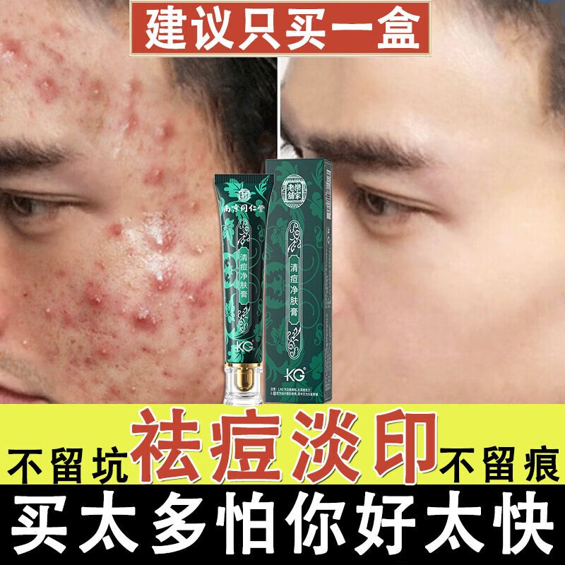 南京同仁堂祛痘膏去痘印痘疤痘坑痘痘肌修护男女学生青春红肿痘闭口粉刺芦荟胶祛痘印凹洞百幽草