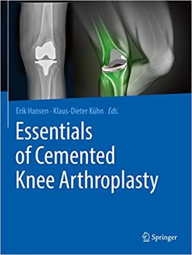 预订 essentials of cemented knee arthroplasty