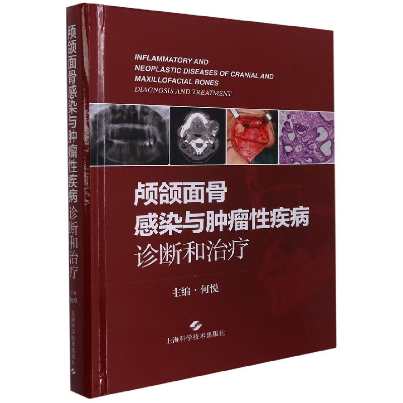 颅颌面骨感染与肿瘤性疾病：诊断和治疗