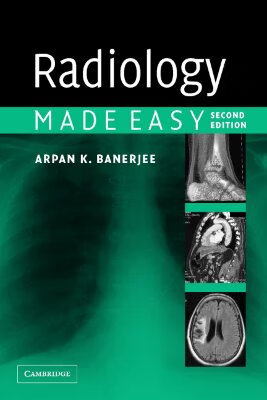【预订】radiology made easy