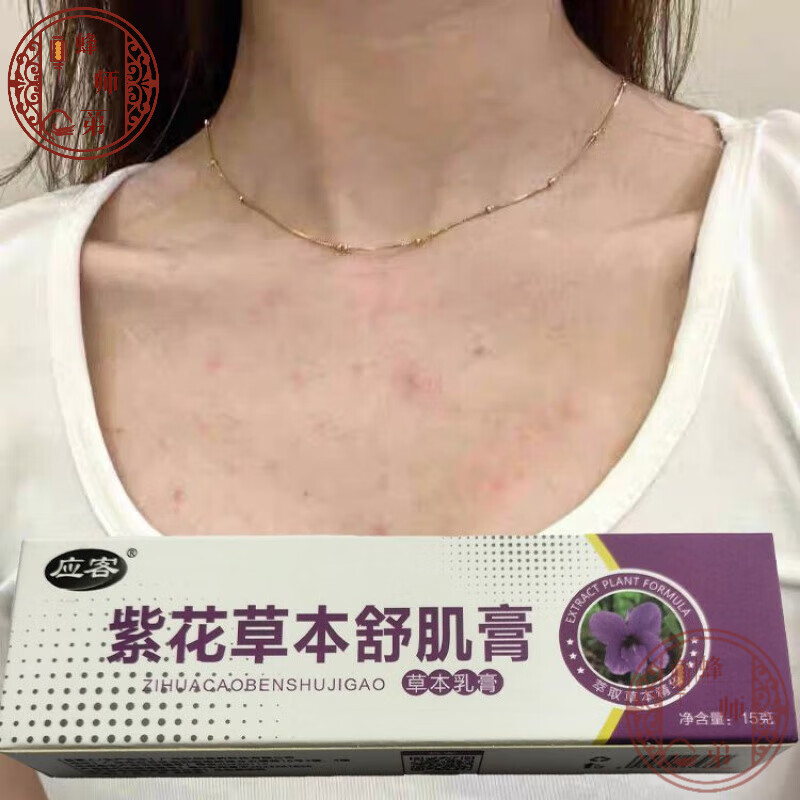 应客紫花草本舒肌膏本草舒极膏身上长痘祛痘润肤舒机膏 一盒装 15g