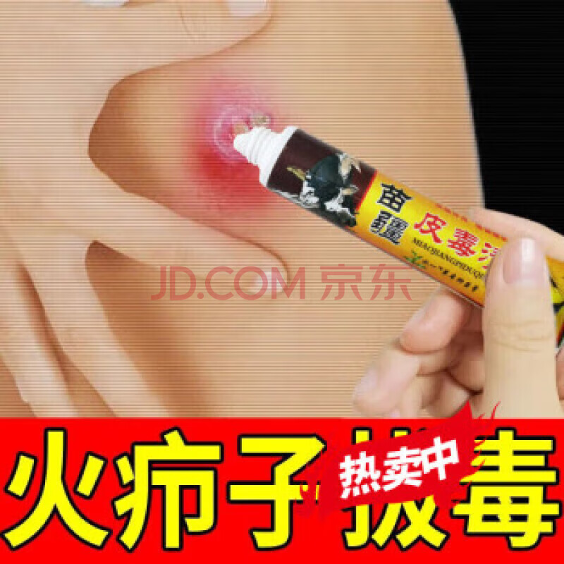 水之善火疖子拔l毒痒拔脓红肿拔l毒疙瘩大脓包痘痘坐扳疮屁股大包去脓 买3+2【五盒巩固装】