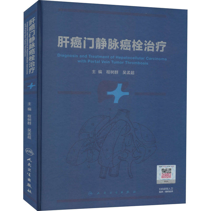 肝癌门静脉癌栓治疗 图书