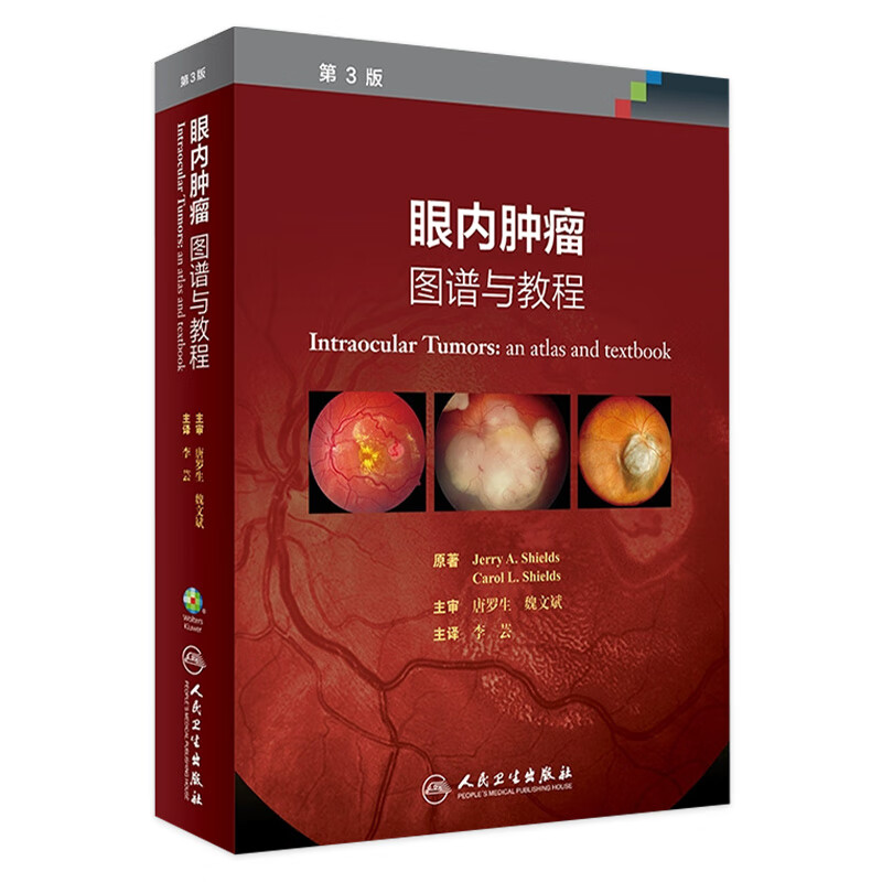 眼内肿瘤：图谱与教程