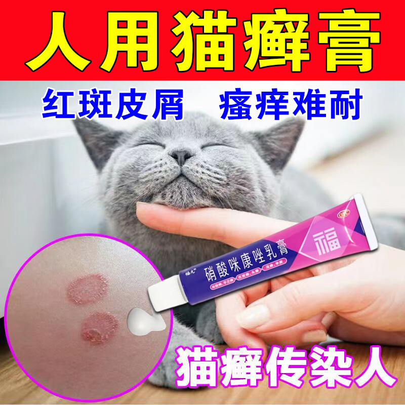 人用猫癣药】人患猫癣狗癣皮肤剧烈瘙痒圆形癣体癣红斑脱屑真菌感染