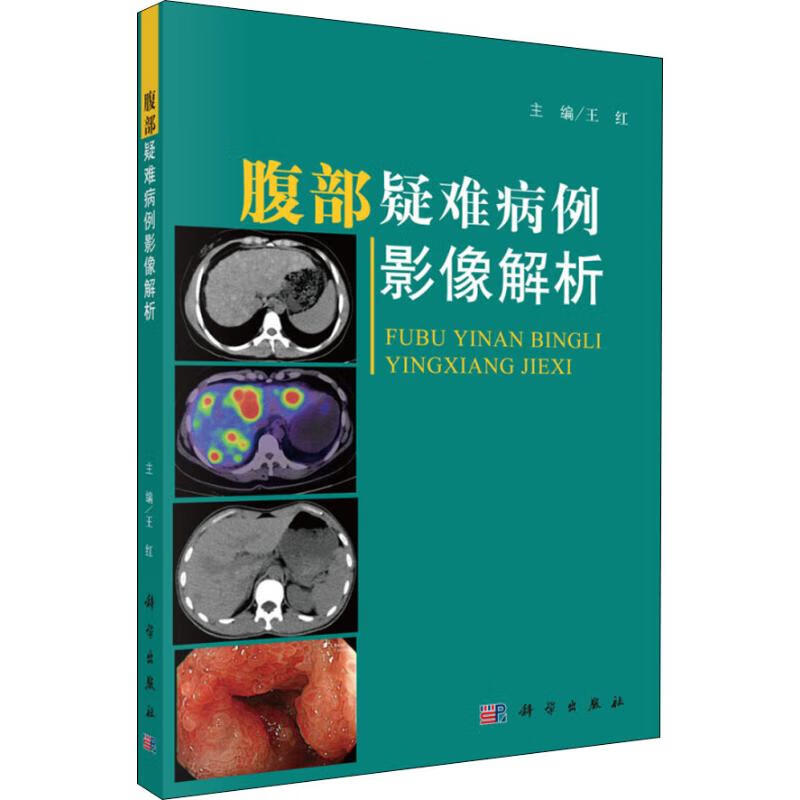 腹部疑难病例影像解析【正版图书】