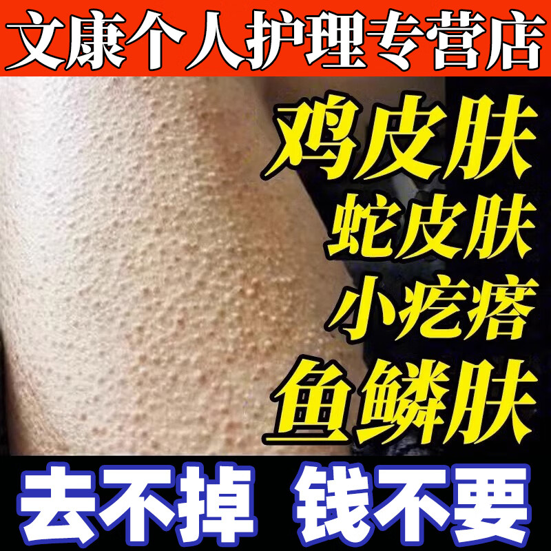 修正鸡皮肤疙瘩毛囊角化去除手臂胳膊上腿上的小疙瘩大腿毛周角化症膏