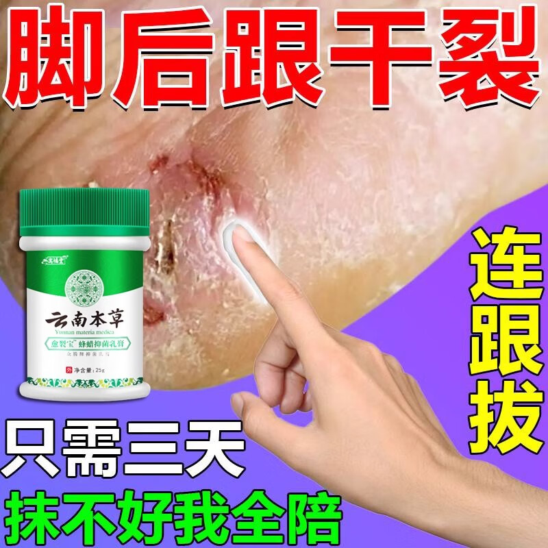寓福堂本草愈裂霜蜂腊脚后跟干裂手足防裂膏开裂裂口脱皮冻伤膏 单盒