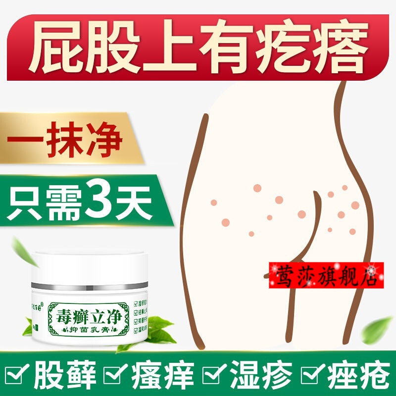 屁股上有疙瘩久坐屁股痒股l藓屁股上长痘痘屁股疮屁股湿l疹