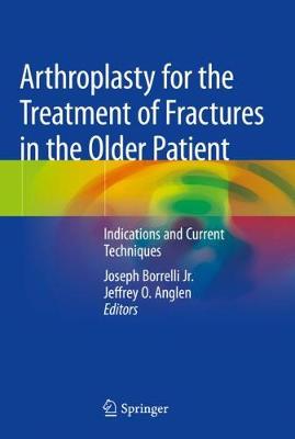 【预订】arthroplasty for the treatment of