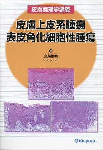 预订 皮膚上皮系腫瘍 表皮角化細胞性腫瘍 皮膚病理学講義