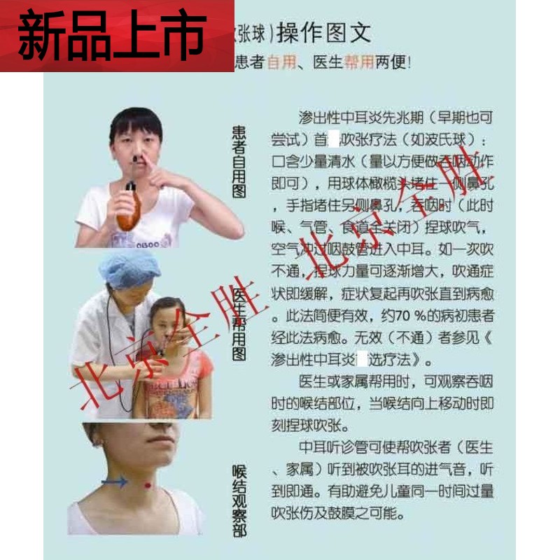 适用于恒压咽鼓管吹张器儿童波氏球分泌性中耳炎鼓膜内陷堵塞耳闷 陷