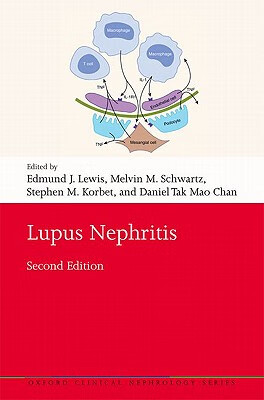 预订 lupus nephritis