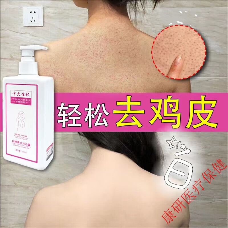 去鸡皮沐浴露全身去角质去死皮沐浴乳身体洗浴盐磨砂膏男女儿童宝宝去