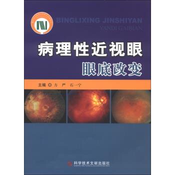 病理性近视眼眼底改变【正版图书】