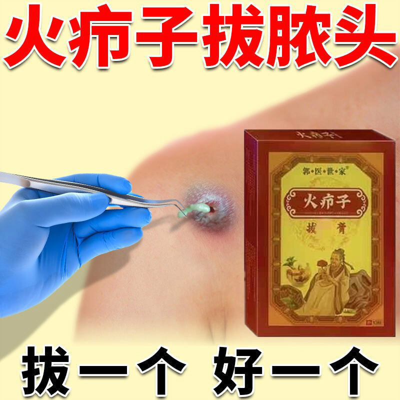 火疖子拔i毒膏贴火疙瘩脓包红肿痒疼大痘痘流脓发热拔脓拔i毒贴 买2 1