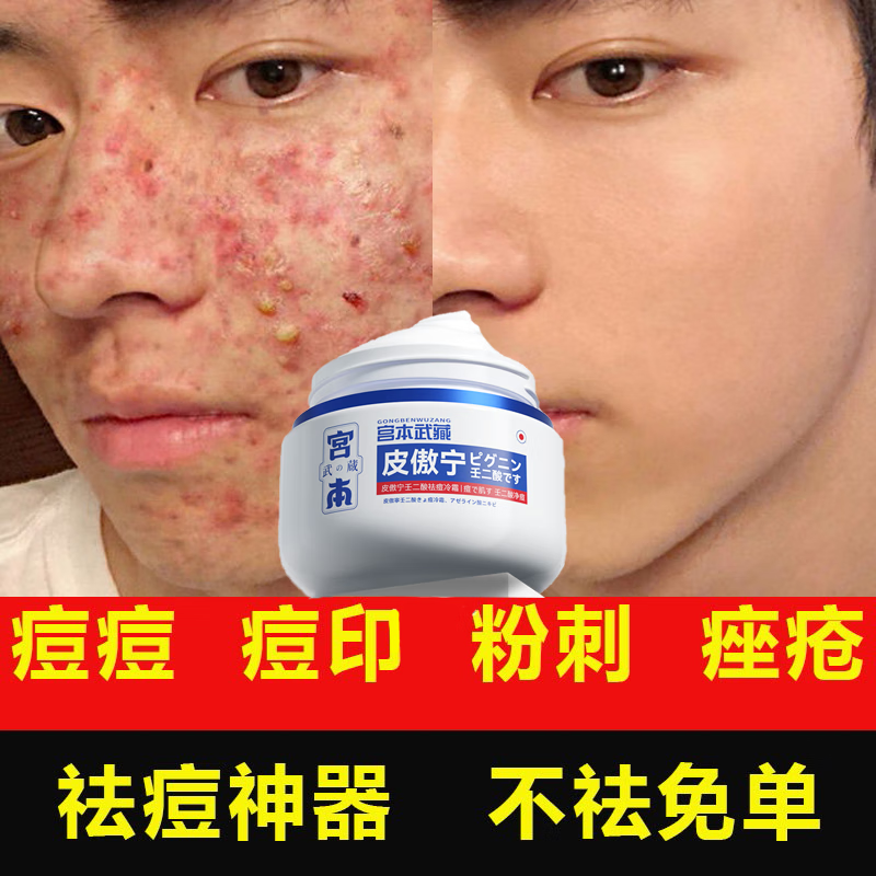 宫本武藏壬二酸15%祛痘膏去痘淡化痘印痘坑修复痘疤青春痘上火痘 一盒体验装【适合轻度痘痘】