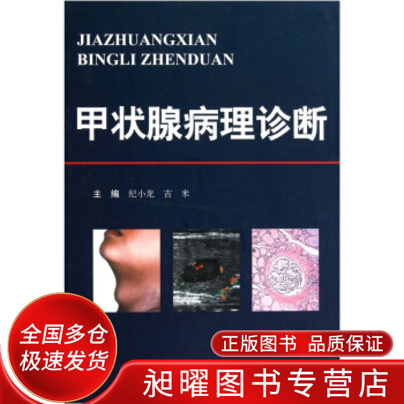 甲状腺病理诊断【精选】