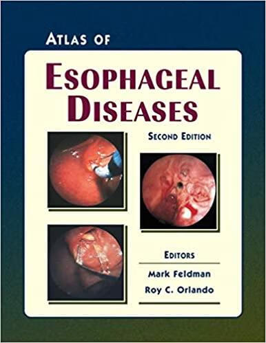 预订atlas of esophageal diseases