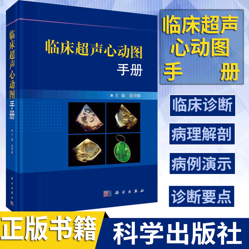 临床超声心动图手册 逄坤静 超声心动图学手册 临床诊断指南 阜外医院