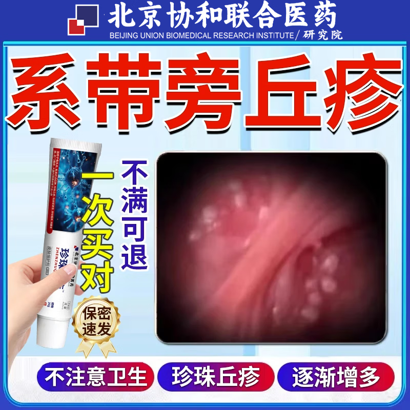 qzgy系带旁丘疹珍珠丘疹专用软膏冠状沟珍珠粒丘疹可搭去除药膏的药mw
