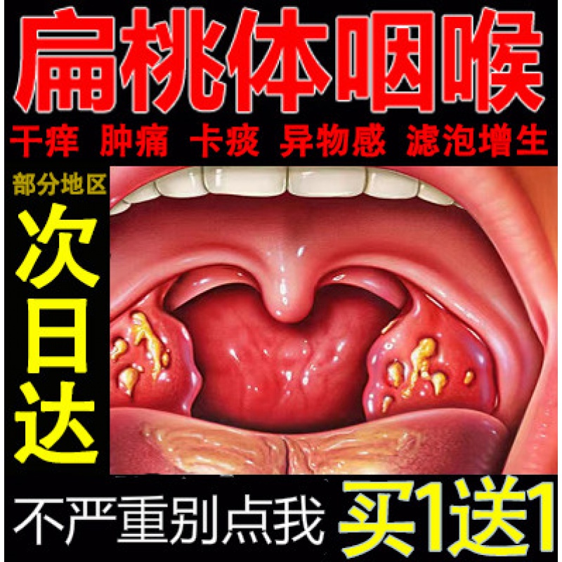 舒特咽部灵冷敷凝胶冷贝口咽喉喷剂诺眼