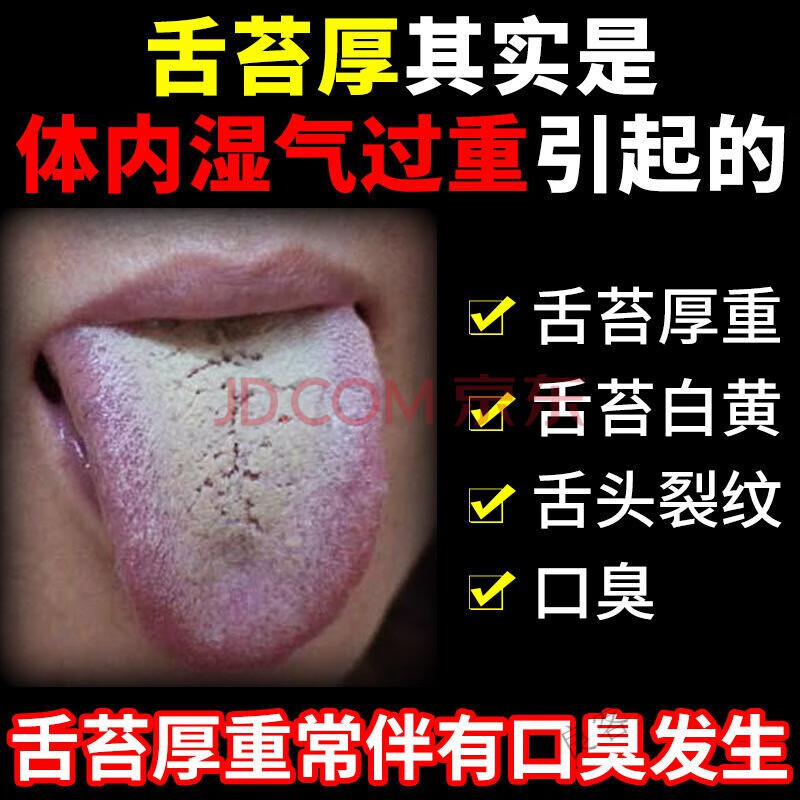 南七珍舌头白舌苔厚舌头发黄口i臭裂纹有异味 1盒