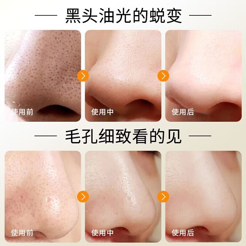 YINBA牛油果泡泡面膜复合酸去黑头粉刺深层清洁毛孔积雪草收缩毛孔yabi 1盒装【体验装】