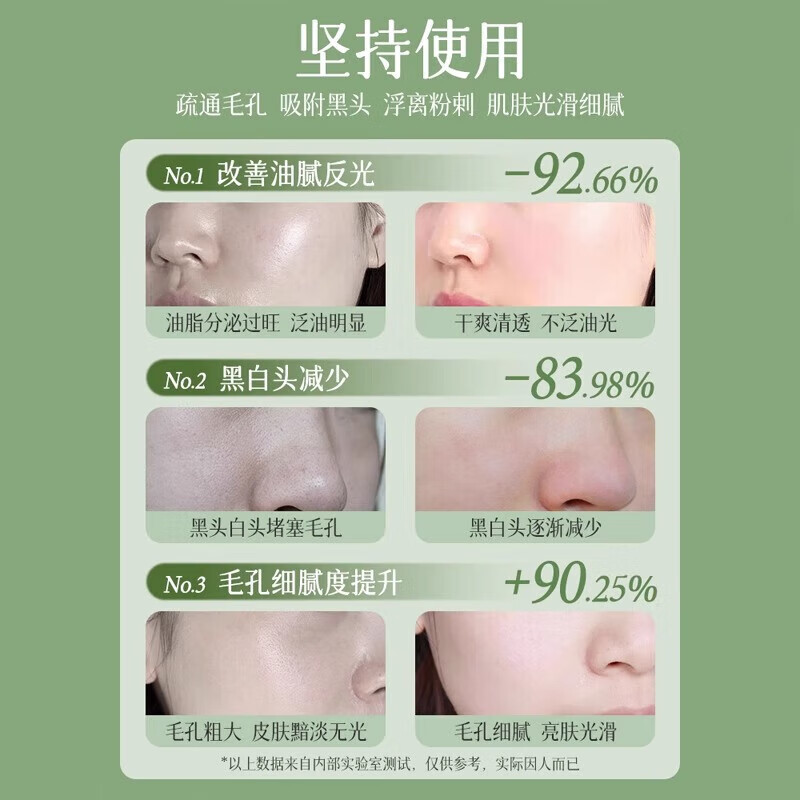 臻芝【旗舰直售】臻芝泥膜清洁去黑头白头闭口粉刺收缩深层清洁毛孔 220g【高性价比】98%用户购买