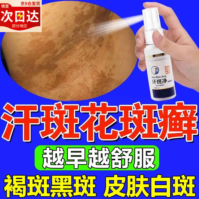 汗斑专用i药花斑癣除褐斑根腋下背部身上白斑玫瑰癣糠疹瘙痒汗斑 单
