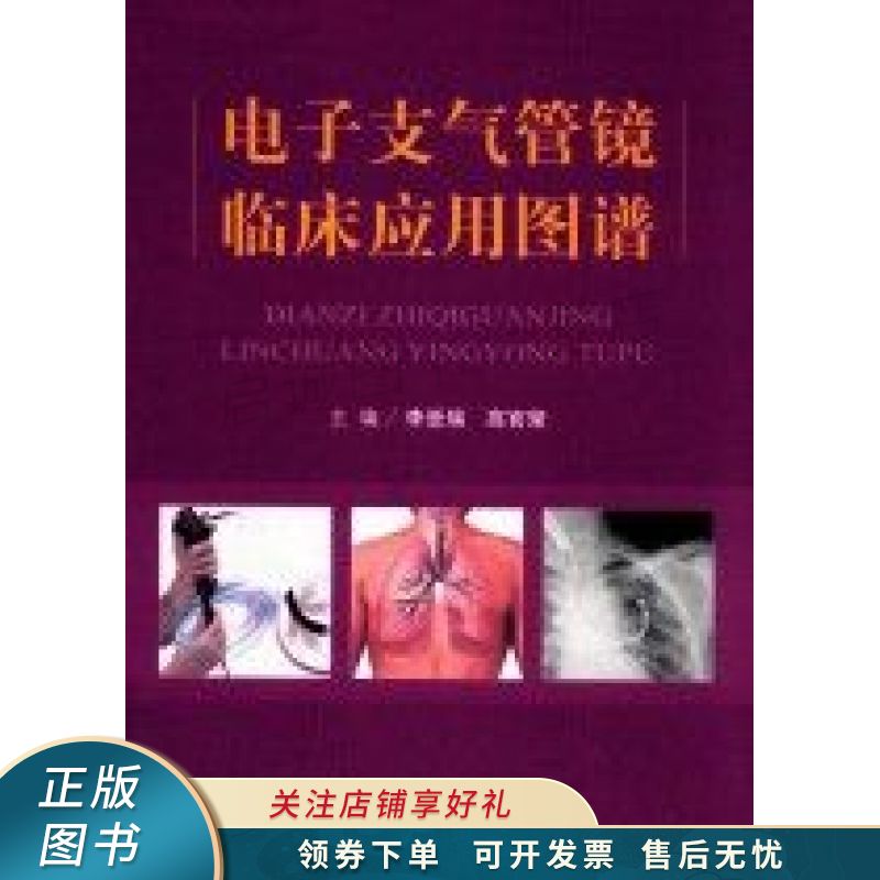 电子支气管镜临床应用图谱 李登瑞