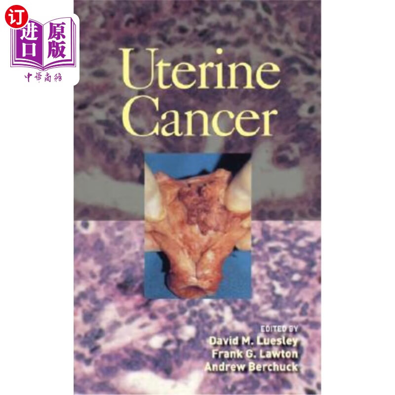 海外直订医药图书uterine cancer 子宫癌