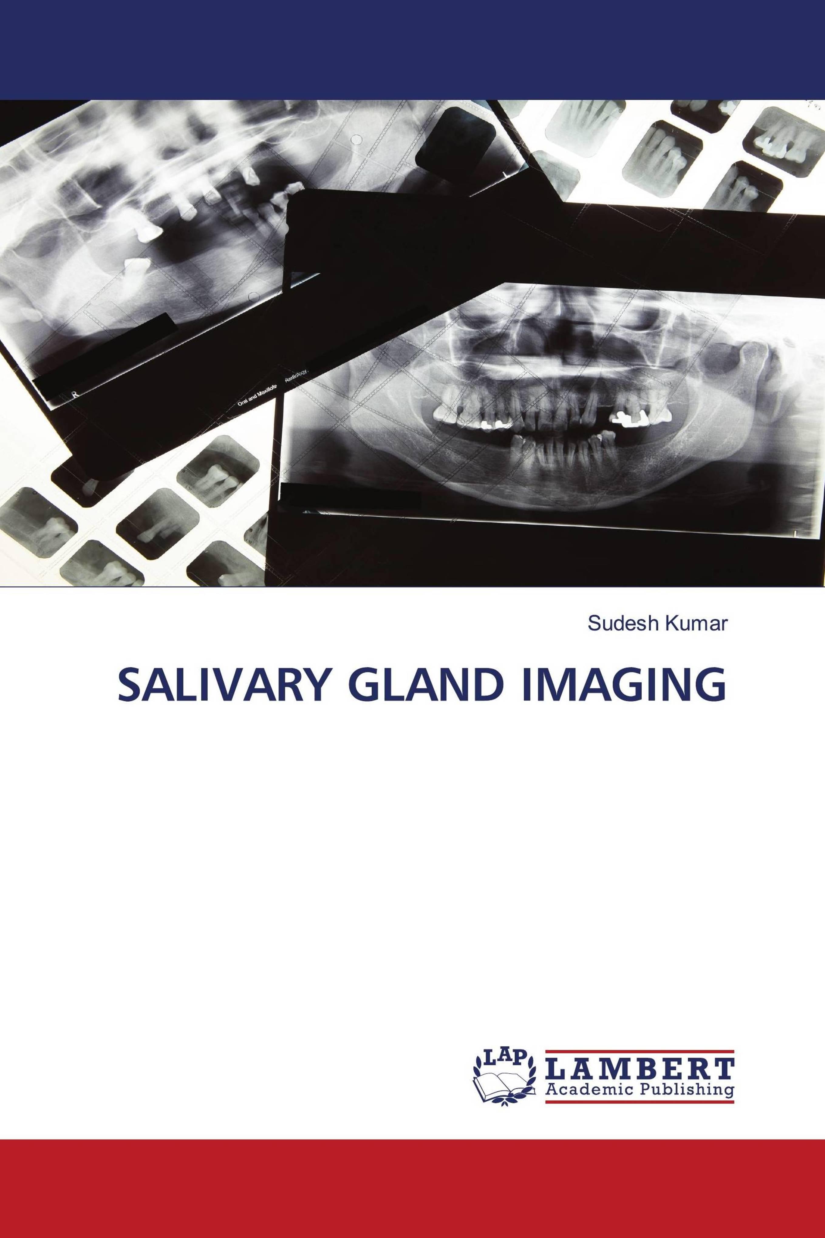 预订Salivary Gland Imaging