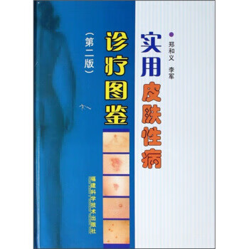 实用皮肤性病诊疗图鉴【正版图书】