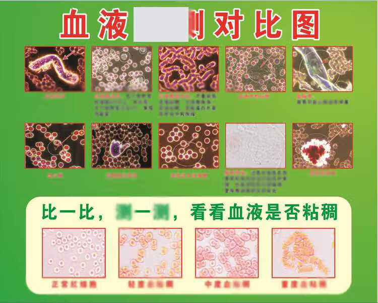 一滴血检测仪专业血液血细胞挂图分析图解显微镜耗材载玻片盖玻片 翠