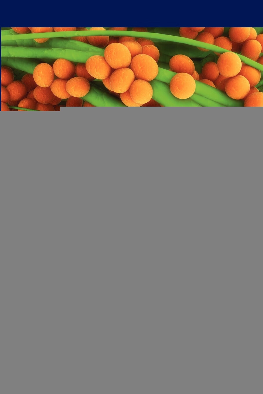 【预售 按需印刷】computational prediction of aggregated